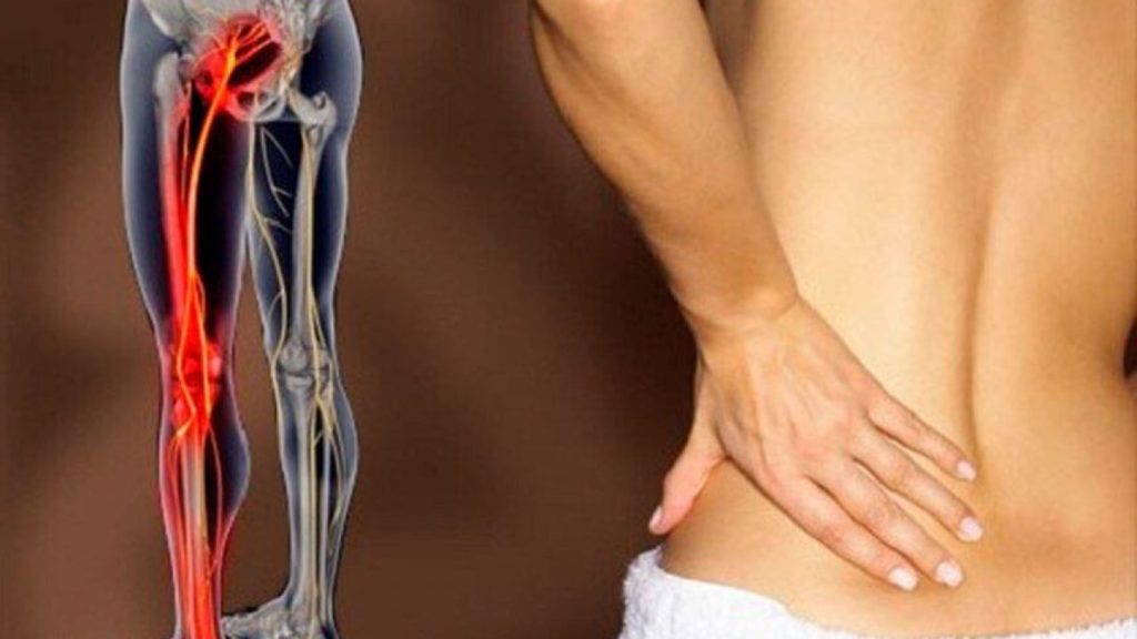Pilates y ciática · Pure Pilates